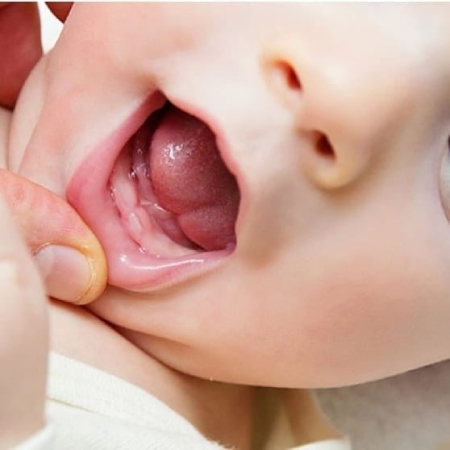 odontopediatria, primeros dientes temporales odontopediatria-primeros-dientes